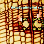 縱向周邊細胞 Axial epithelial cells