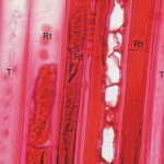 樹脂管胞 Resinous tracheid