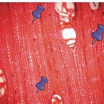 單列或細切線狀薄壁細胞 (微) Uniseriate or narrow band of metatracheal parenchyma