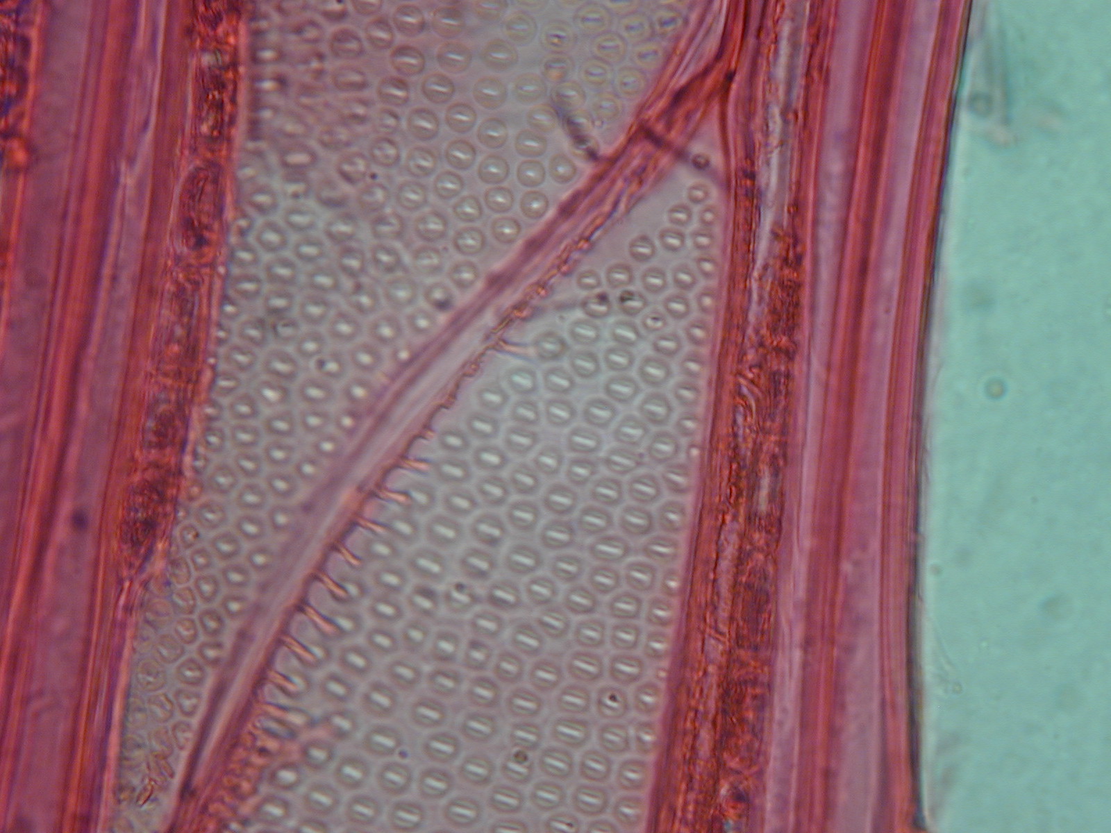 孔纹导管显微图图片