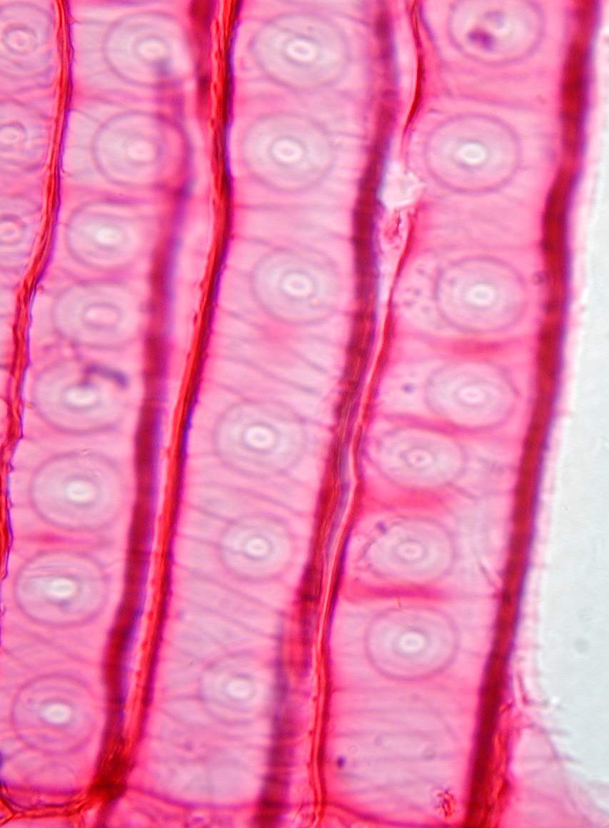 黄豆芽导管显微图图片